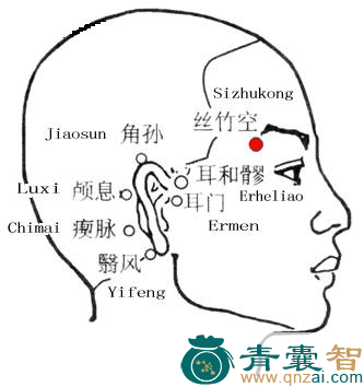 丝竹空穴位置图解