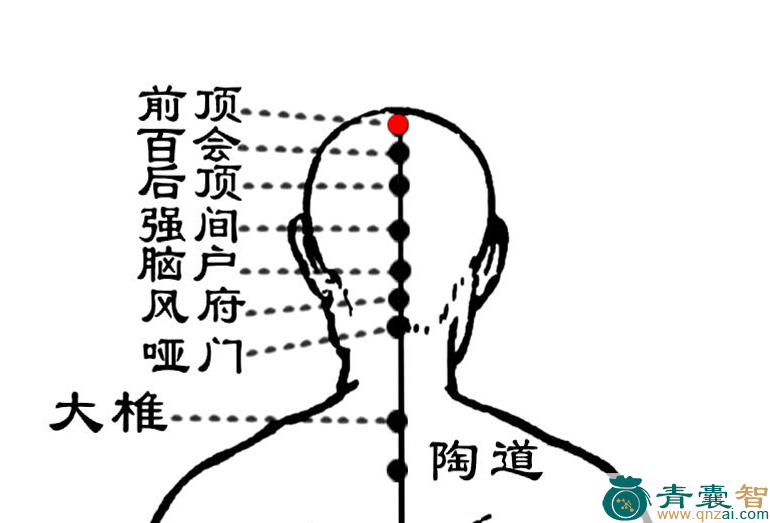 前顶穴位置图解