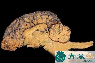 中药材狗脑髓图片