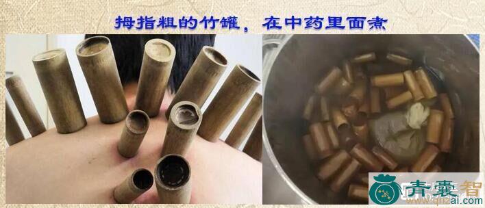 中药材酸罐罐图片